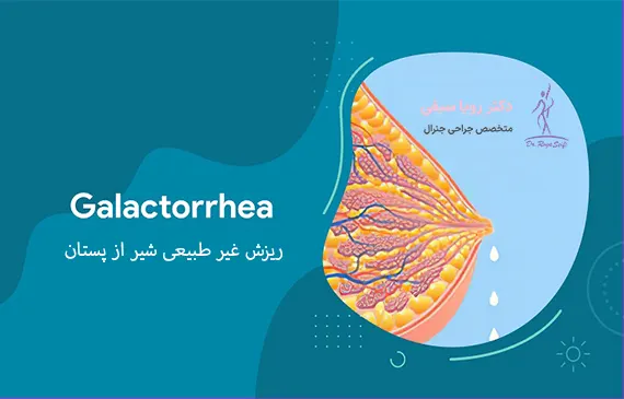 ریزش غیر طبیعی شیر از پستان