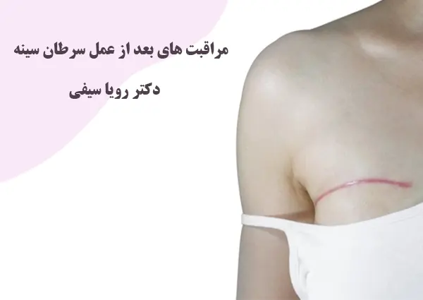 مراقبت های بعد از عمل سرطان سینه