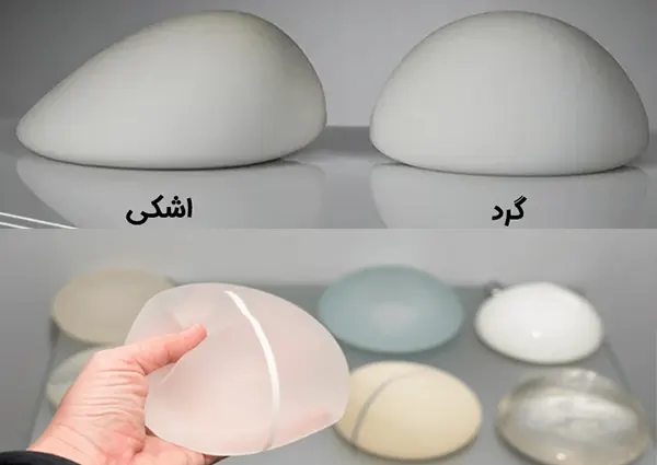 انواع مدل های پروتز سینه