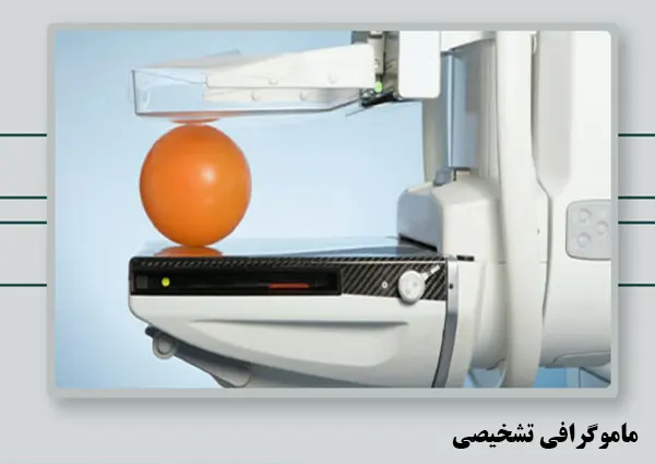 ماموگرافی تشخیصی