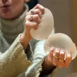 پارگی پروتز سینه