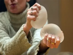 پارگی پروتز سینه