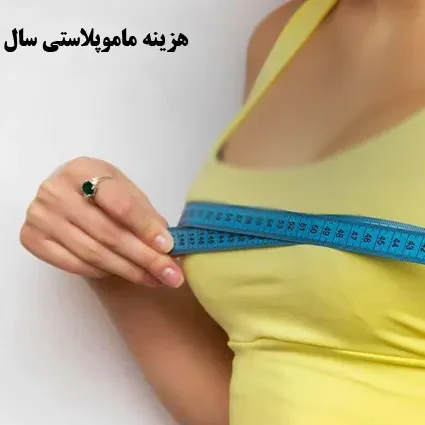 هزینه مامو سال 1404